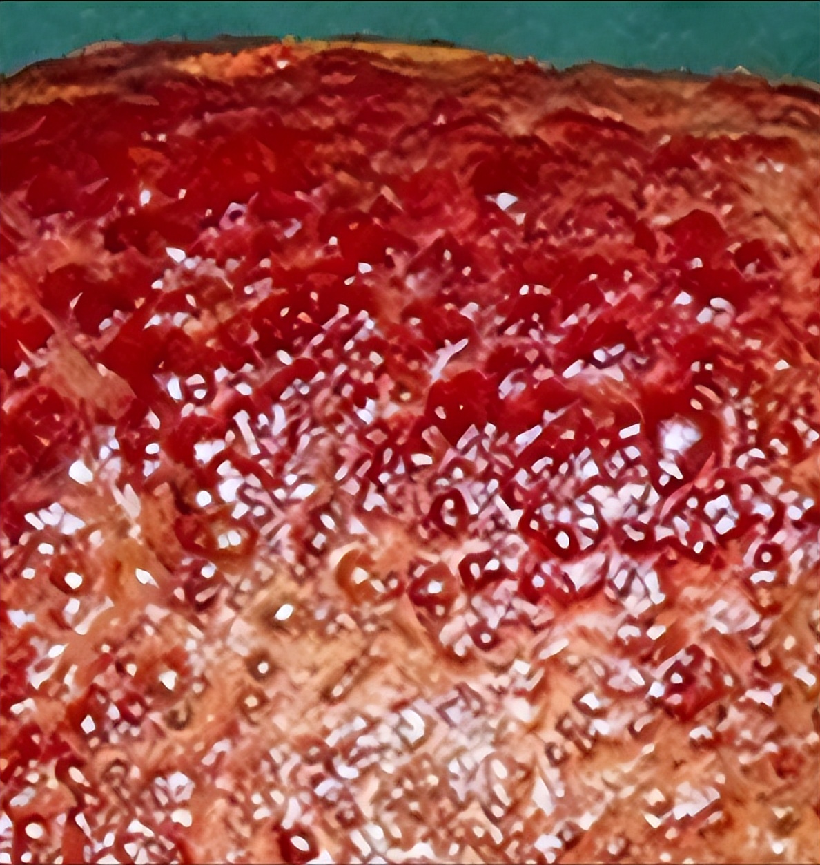 乙肝抗病毒治疗2年表面抗原升高,乙肝抗病毒后数值上升