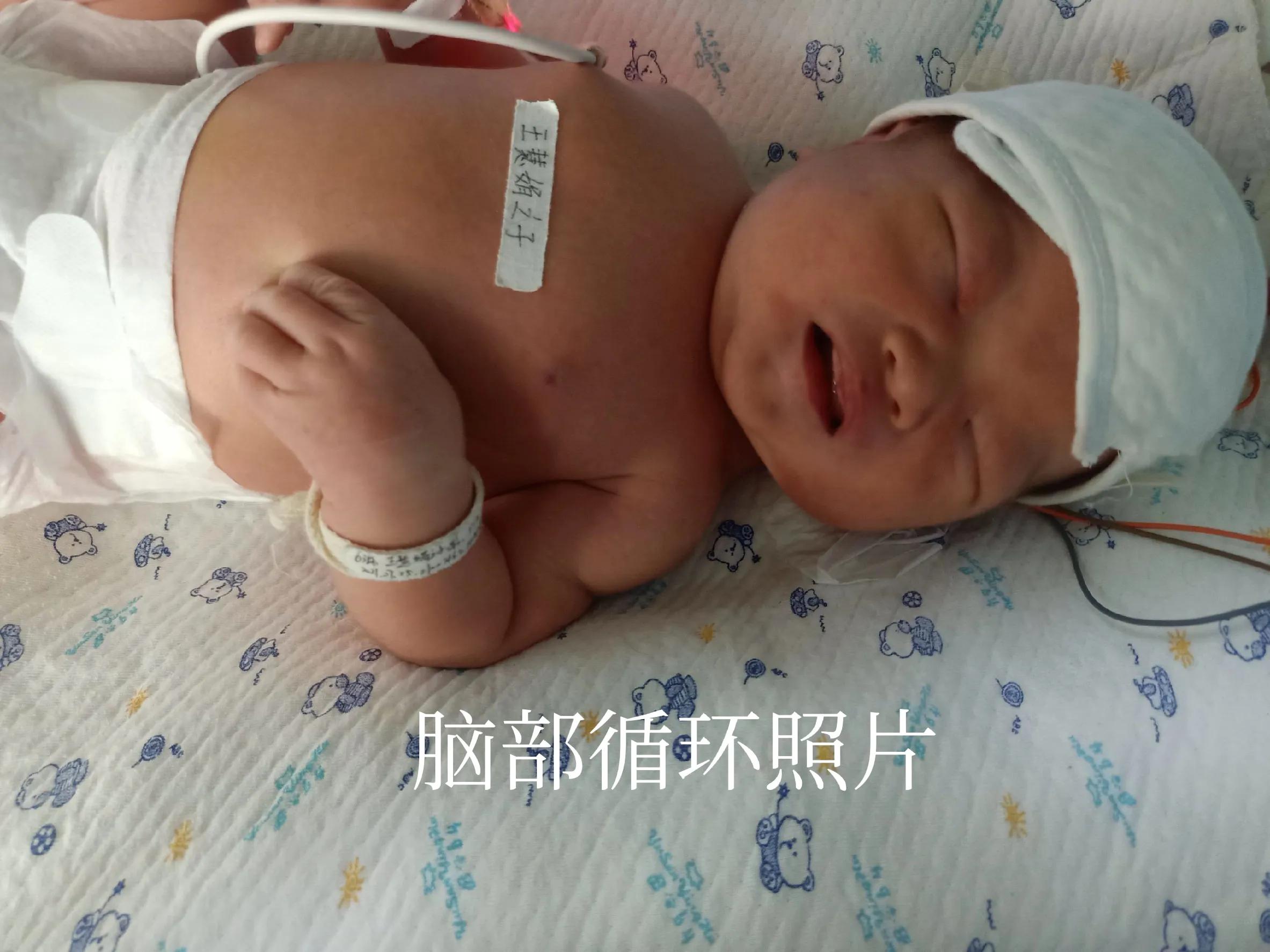 宝宝出生经历磨难,宝宝出生经历了哪些过程