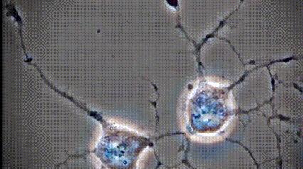 运动神经元显微镜观察内容与结果,显微镜下观察神经元的判断依据