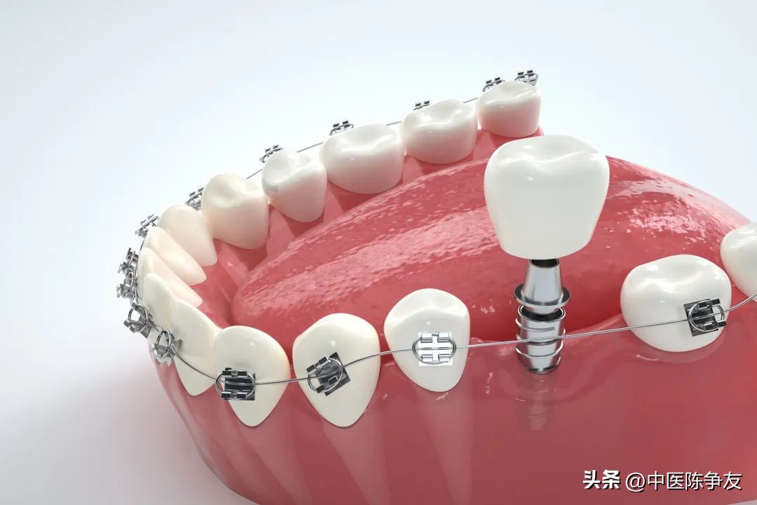 小孩子早起口臭,早起口臭是啥原因