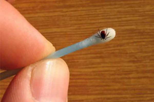 小时候头上长虱子的事,小时候头上的虱子是什么样子的