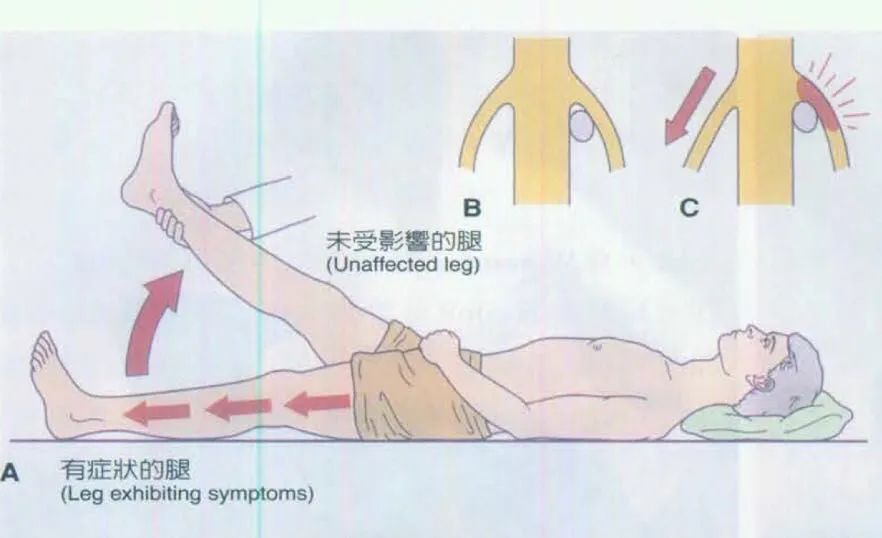 年纪轻轻腰椎间盘突出怎么锻炼,年纪轻轻腰椎间盘突出