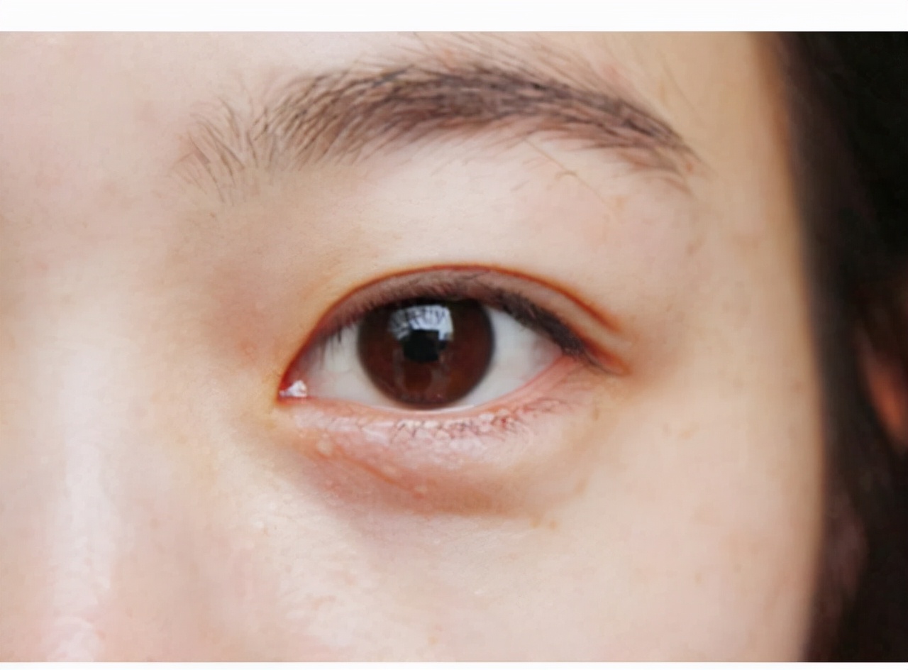 左眼皮上眼皮跳是什么预兆呢,左眼皮上眼皮跳是好运还是厄运