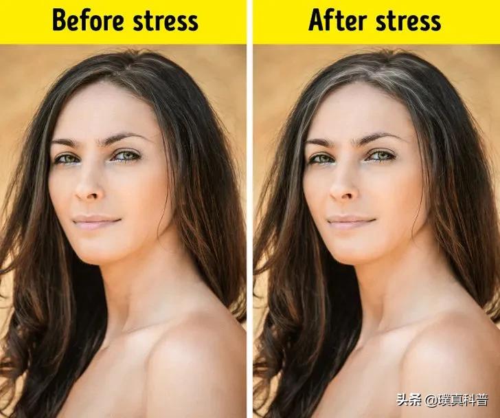 有白头发要怎么才能恢复黑发,为什么会长白头发怎么让头发变黑