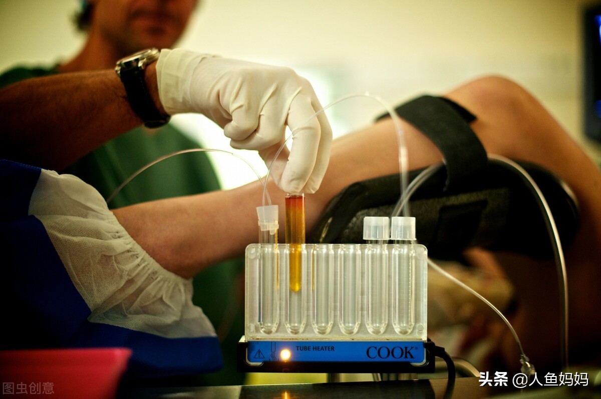 孕妇双胞胎做羊膜穿刺,怀双胞胎产检全过程