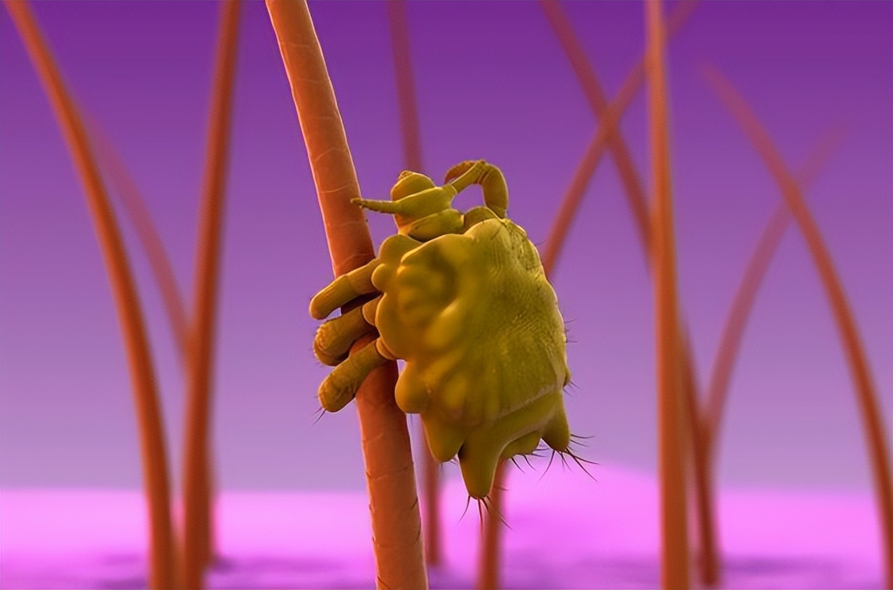 什么是阴虱阴虱是怎么得的,阴虱到底是什么原因引起的