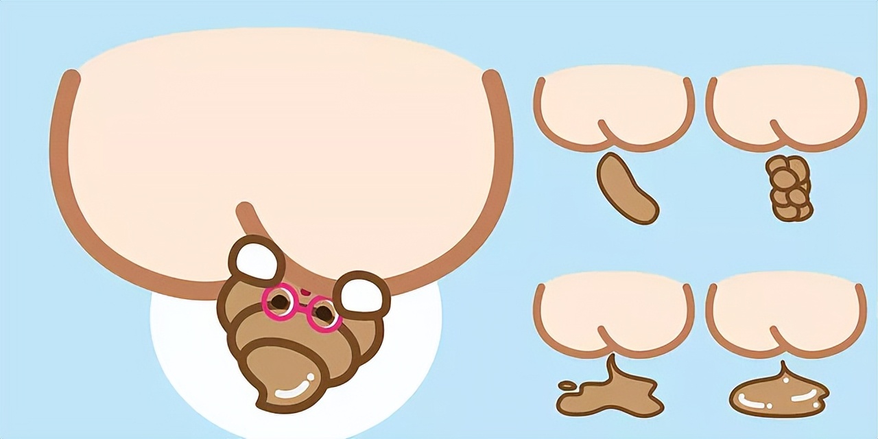 直肠癌多半是拖出来的,直肠癌最好的5个征兆