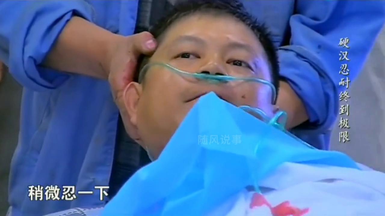 男子手指被压断淡定走路去医院,手掌被压了一个小时