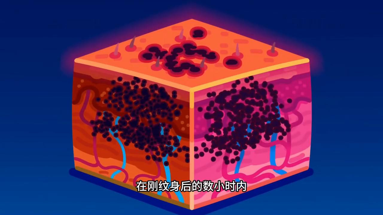 纹身伤免疫系统吗,纹身的伤害视频