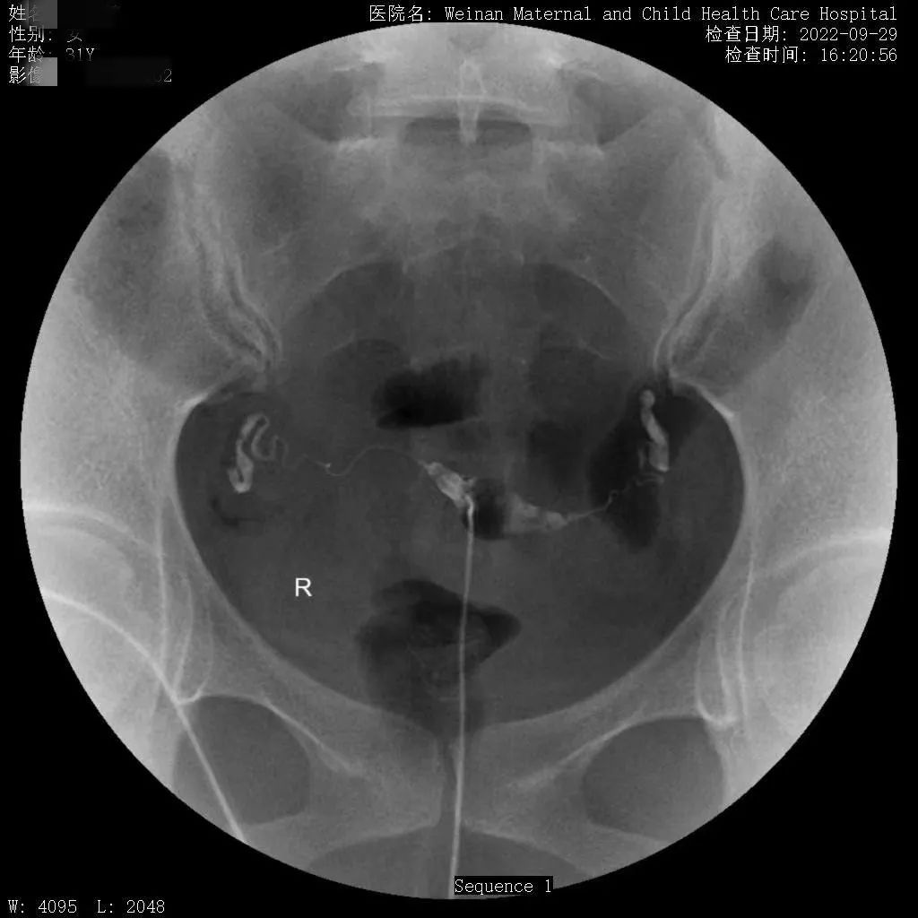 致敬公司的摄影师,美女致敬摄影师视频