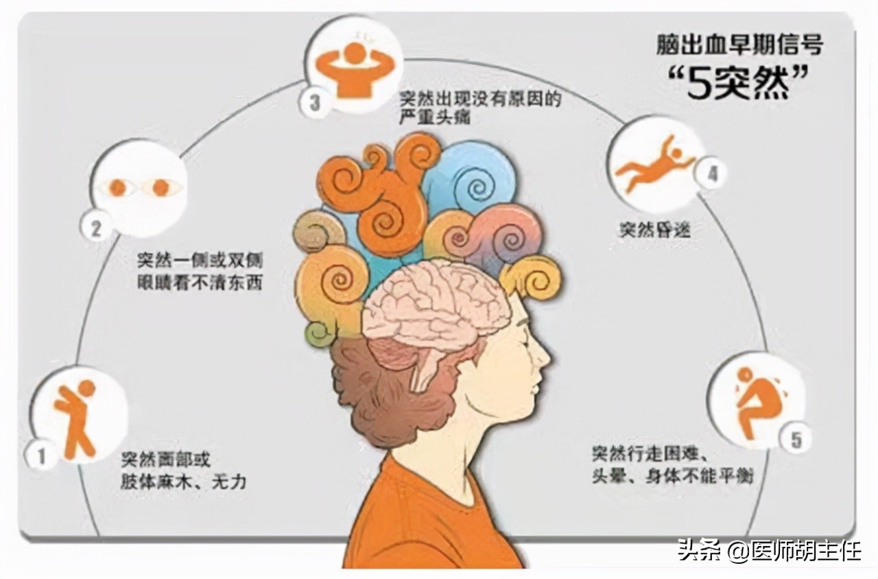 脑血管畸形导致的脑出血怎么急救,家里老人脑出血应该怎样安慰