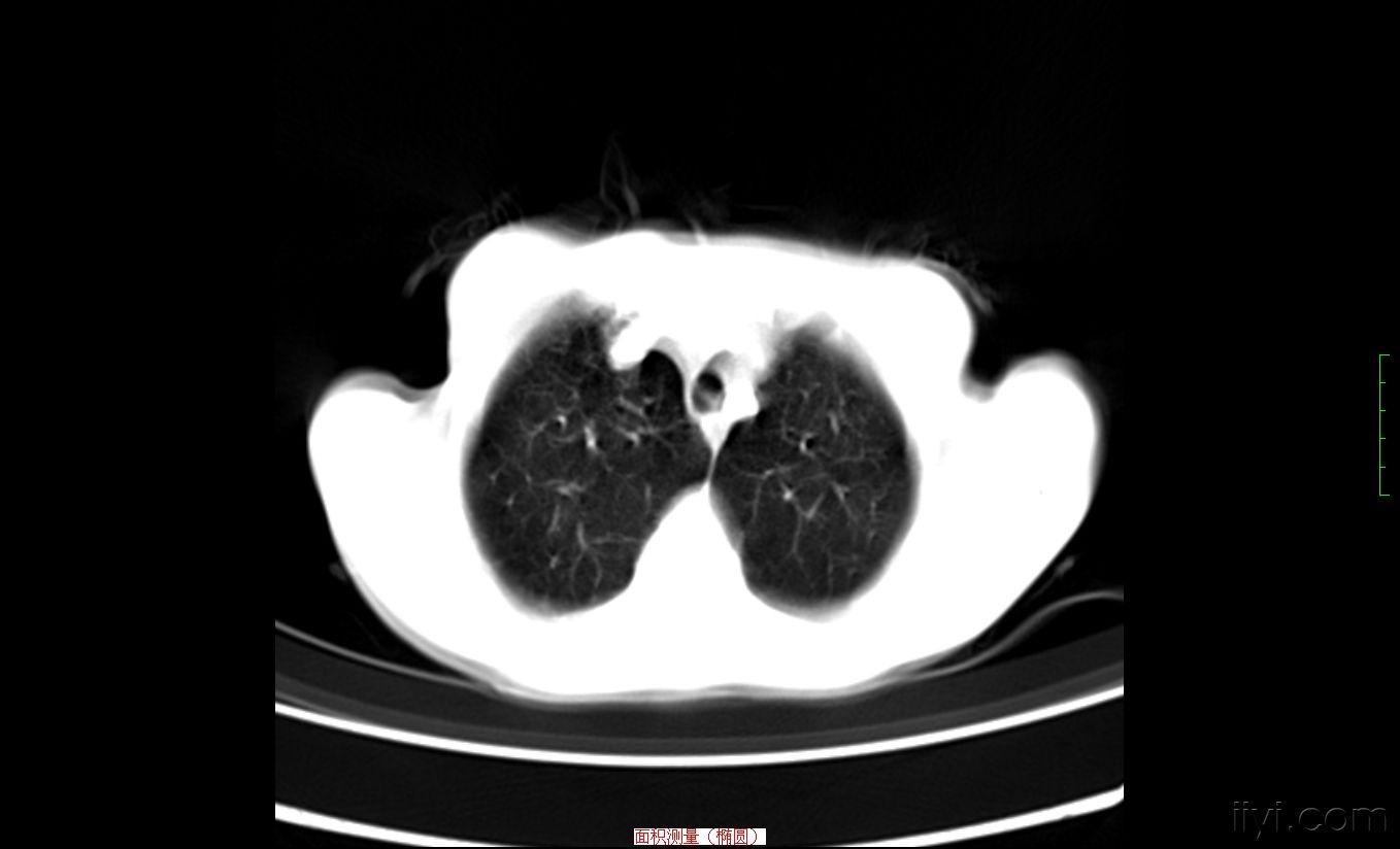 治疗牙痛的甲硝唑多少钱一盒,甲硝唑治牙痛一次用几粒