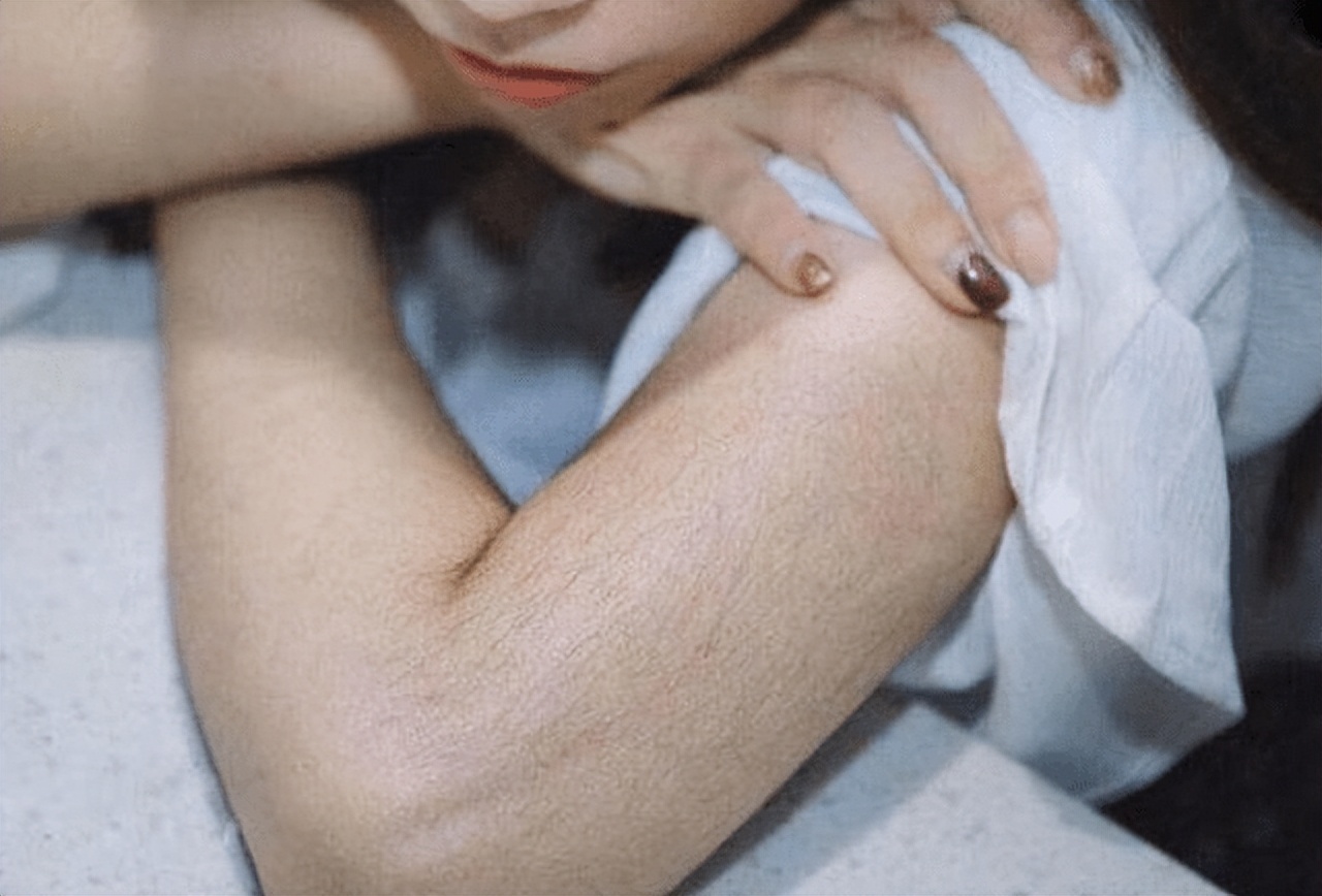女性体毛重的症状都有什么,女性体毛生长旺盛与哪些原因有关