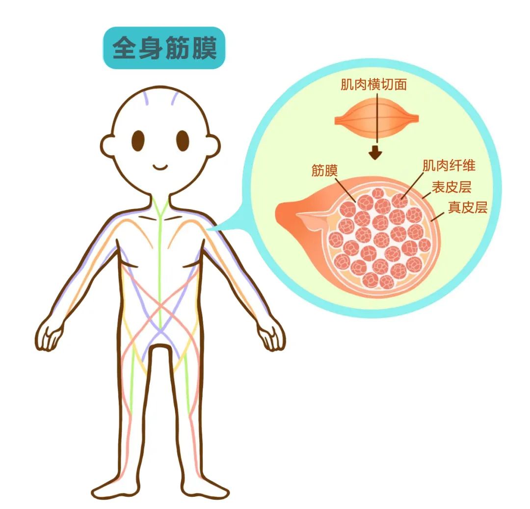 筋膜炎会腰酸背痛吗,腰部筋膜炎会导致腰背胀吗