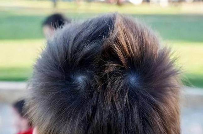 孩子头上的旋有什么含义,孩子头上的旋代表着什么