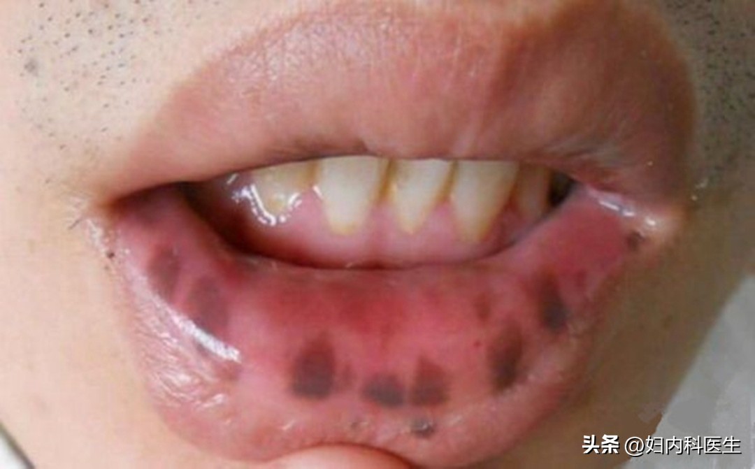 从脸色看出得什么病,面色反映一个人的健康