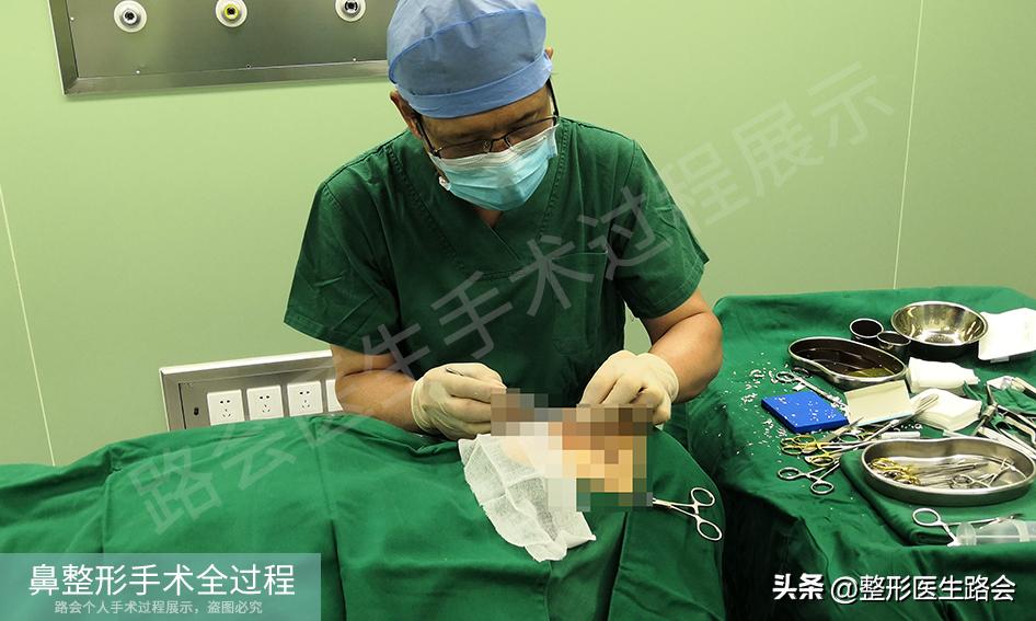 隆鼻手术全过程女生,隆鼻手术到底是怎么进行的