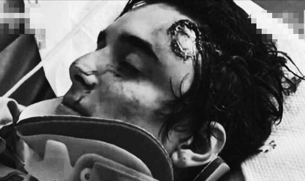 1998年美国温顺杂交犬咬死女主人,1998年温顺杂交犬将主人折磨致死