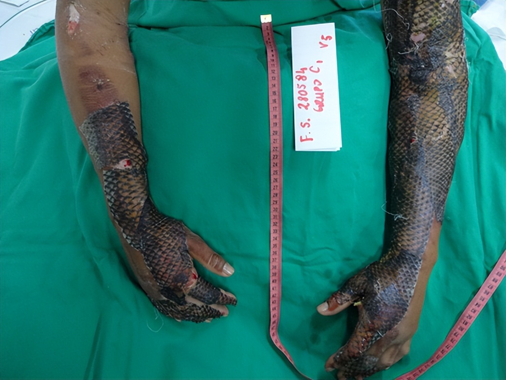 入侵我国水域的罗非鱼，美国人大快朵颐，为何中国吃货解决不了？