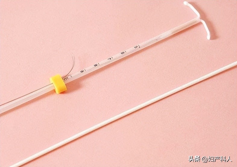 曼月乐又名什么,安了一年的曼月乐