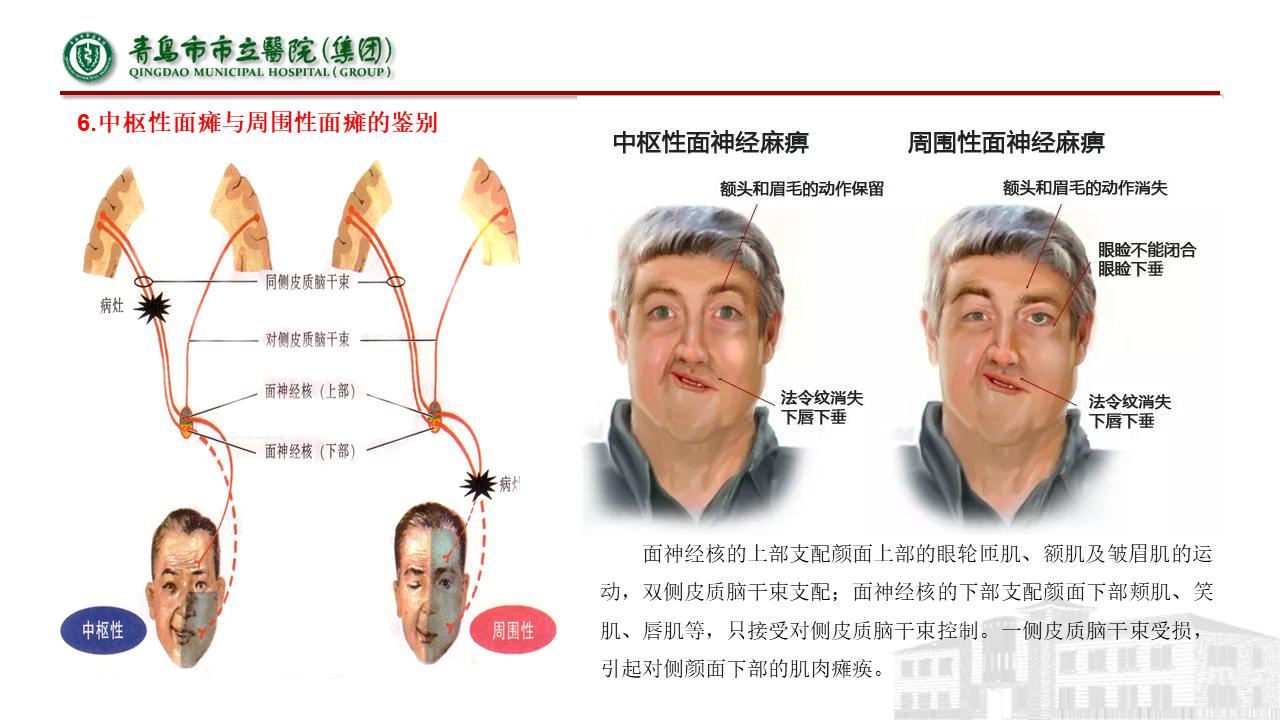 神经内科疾病临床诊疗思维,神经内科理论知识总结