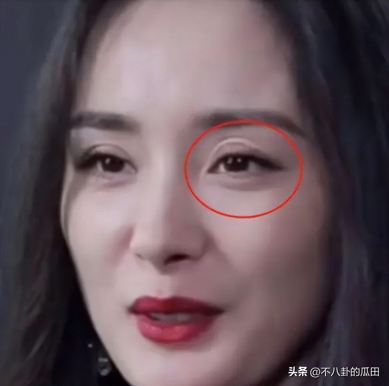 瘦到脱相的几位明星,12位瘦脱相的明星憔悴苍老