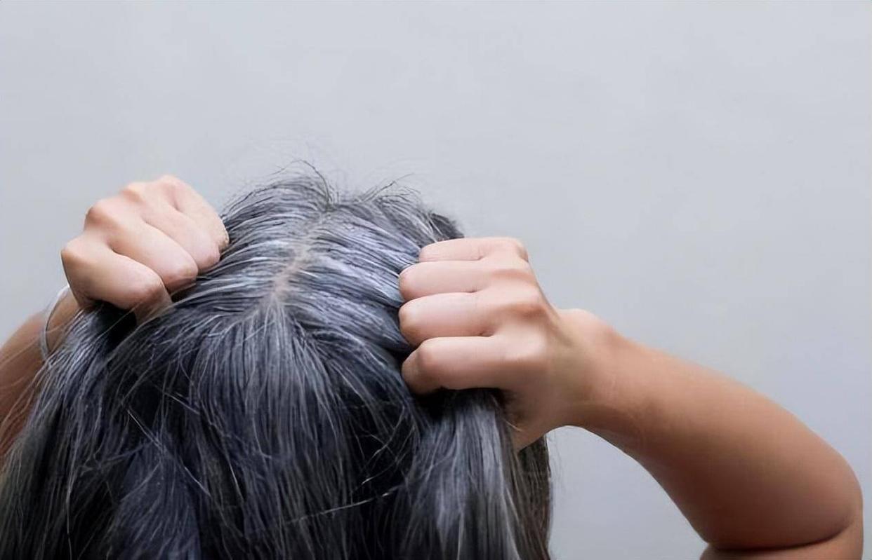 白发长在头中间预示什么病,孩子两鬓和后脑勺白发是什么原因