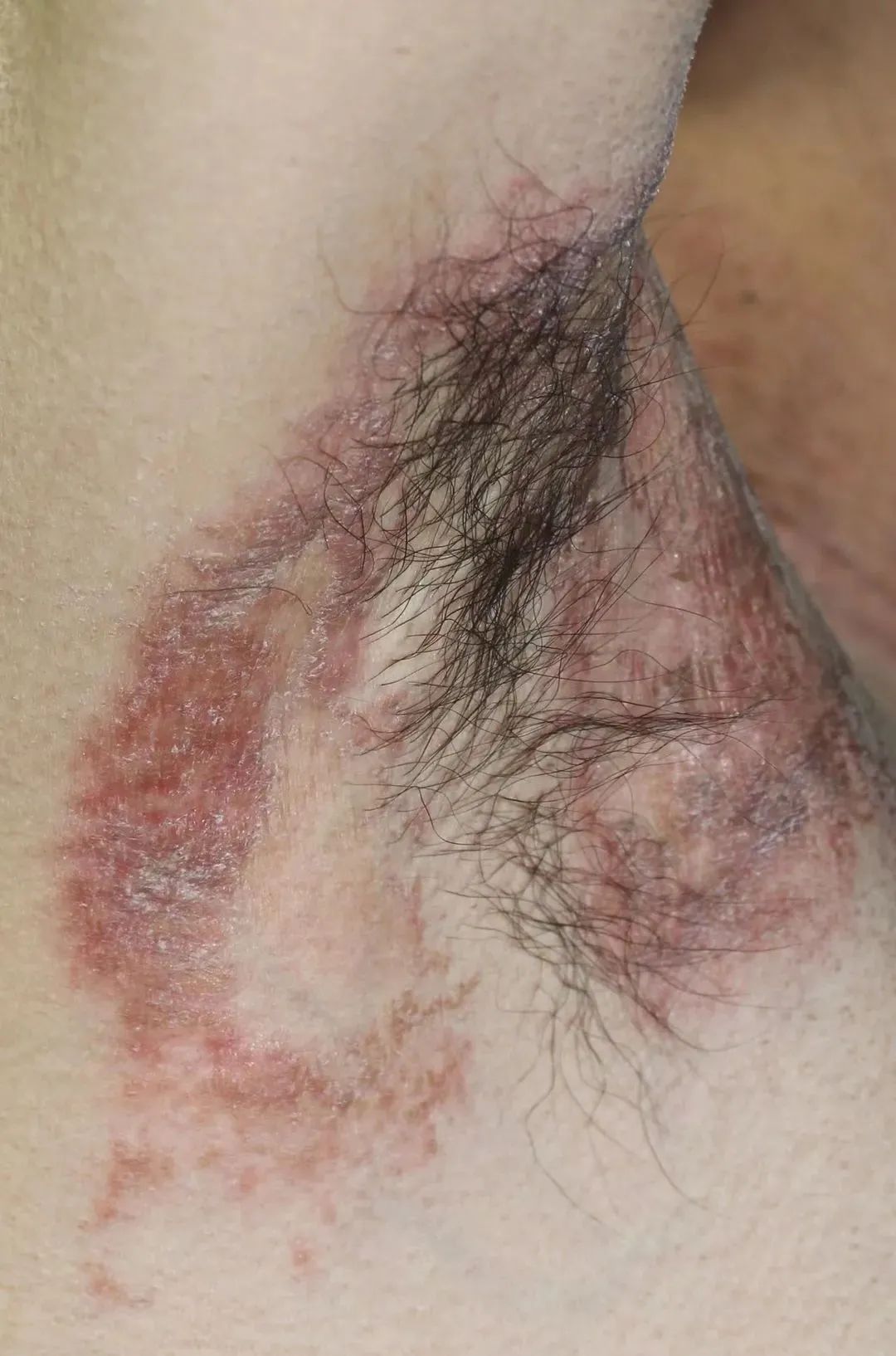 皮肤可以用的洗衣消毒液,洗衣液用的太多会导致皮痒吗