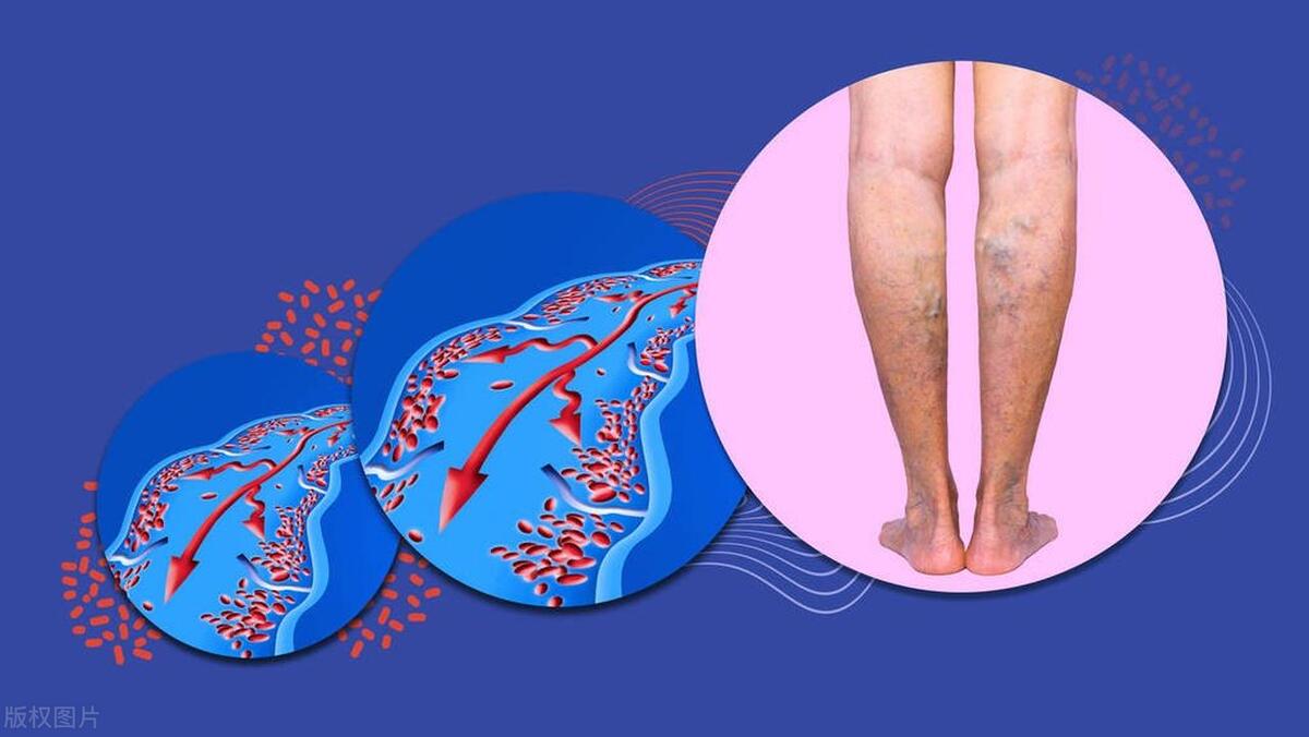 血管外科是做介入吗,介入血管外科门诊是治什么病的