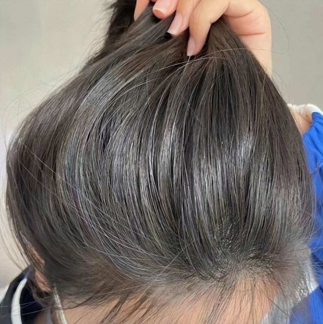 头顶一片光秃秃？过来人教你3招让发量翻倍！抓紧时间做起来！