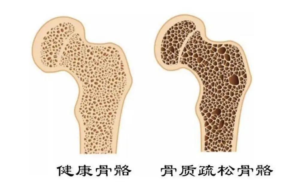 水肿引起的缺蛋白怎么办,缺少营养造成水肿怎么补回来