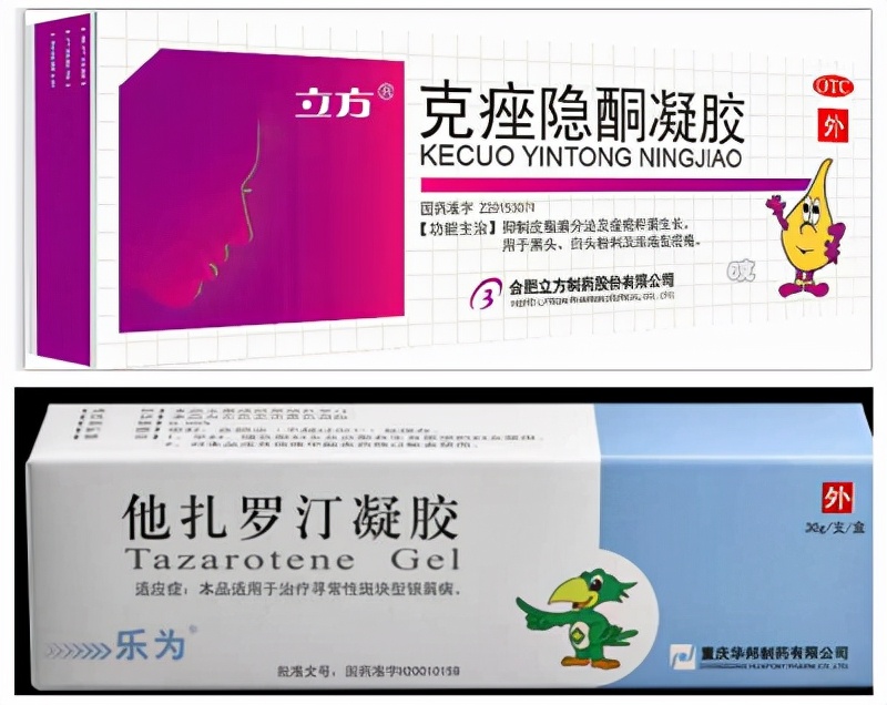 去鼻子黑头粉刺的过程,镊子去除鼻子上的黑头