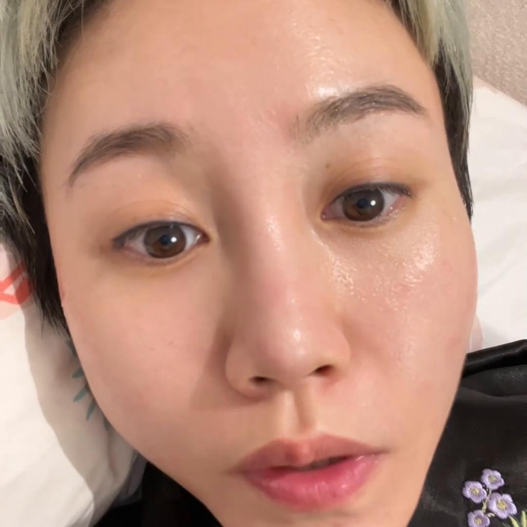 30岁容易长痘用什么洗面奶,30岁脸上突然长痘怎么回事