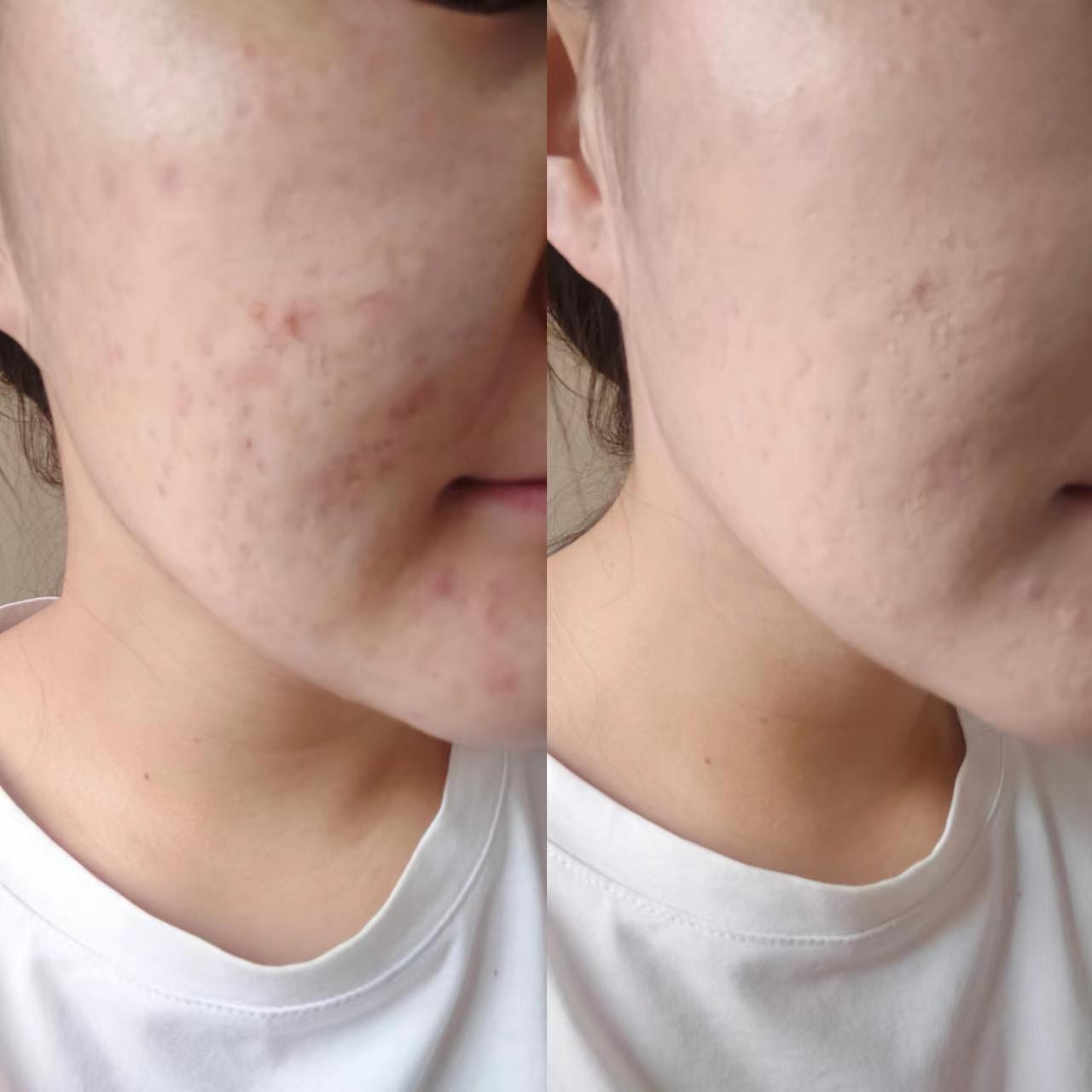 ysl银气垫和皮气垫的区别,Ysl皮气垫干皮测评