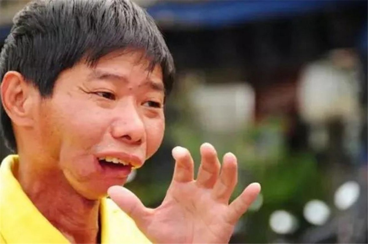 一级致癌物的槟榔危害有多大,槟榔是国际公认的致癌物