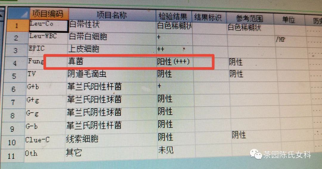 你认为的真菌阴道炎就仅仅是阴道炎？