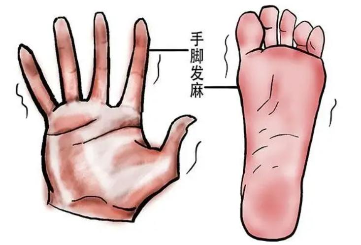 木，就是堵了！张仲景的一张方，通经络，疏血瘀，专治手脚麻木