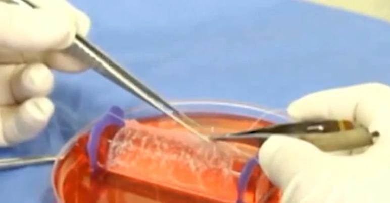 人造人体所有器官未来有可能吗,人造器官心肝脾肺肾脏