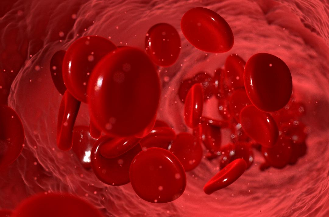 同型半胱氨酸会引起高血压咋治疗 (高血压患者伴随高同型半胱氨酸)