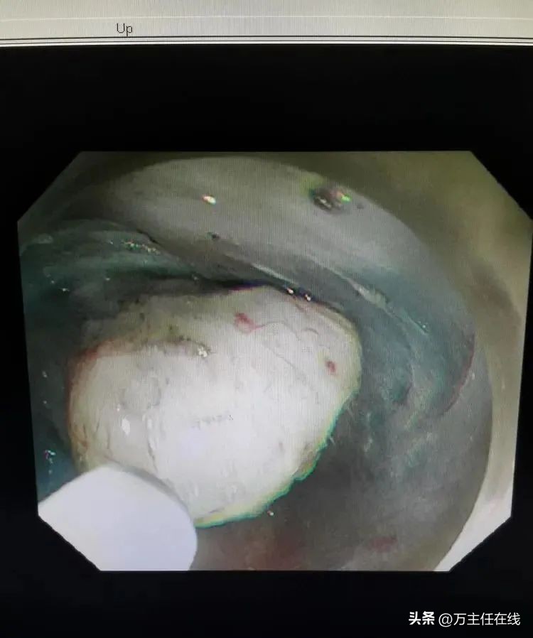 万荣教授上海市第一人民医院,消化内科专家手术