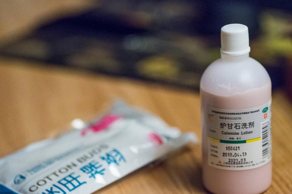 炉甘石洗剂功效多少钱一瓶,国字号炉甘石洗剂的功效与作用