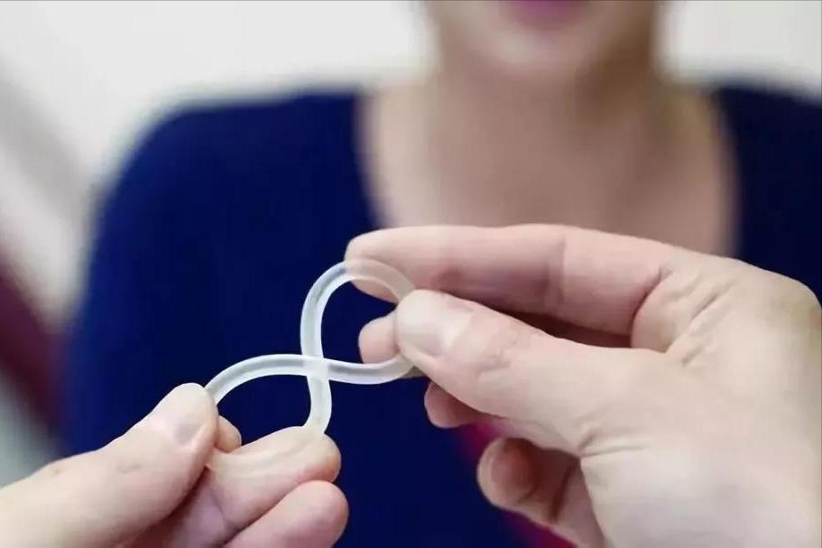 节育环在女性体内会发生什么变化？30年前上环的女性，有哪些结局