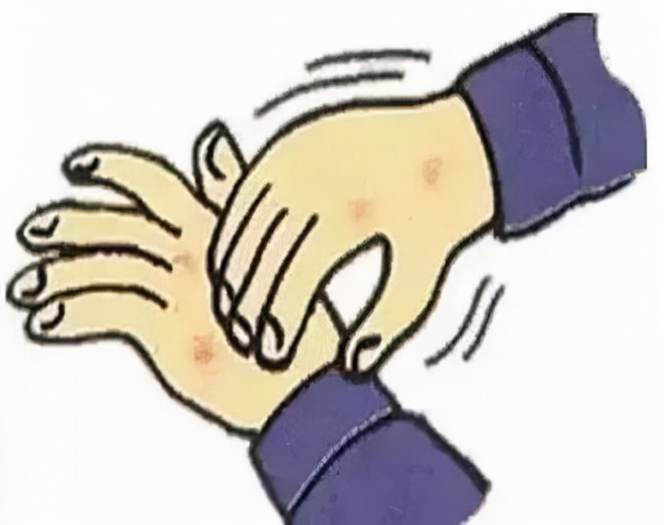 手癣和手部皲裂性湿疹的区别,手部湿疹和手癣的鉴别点主要为