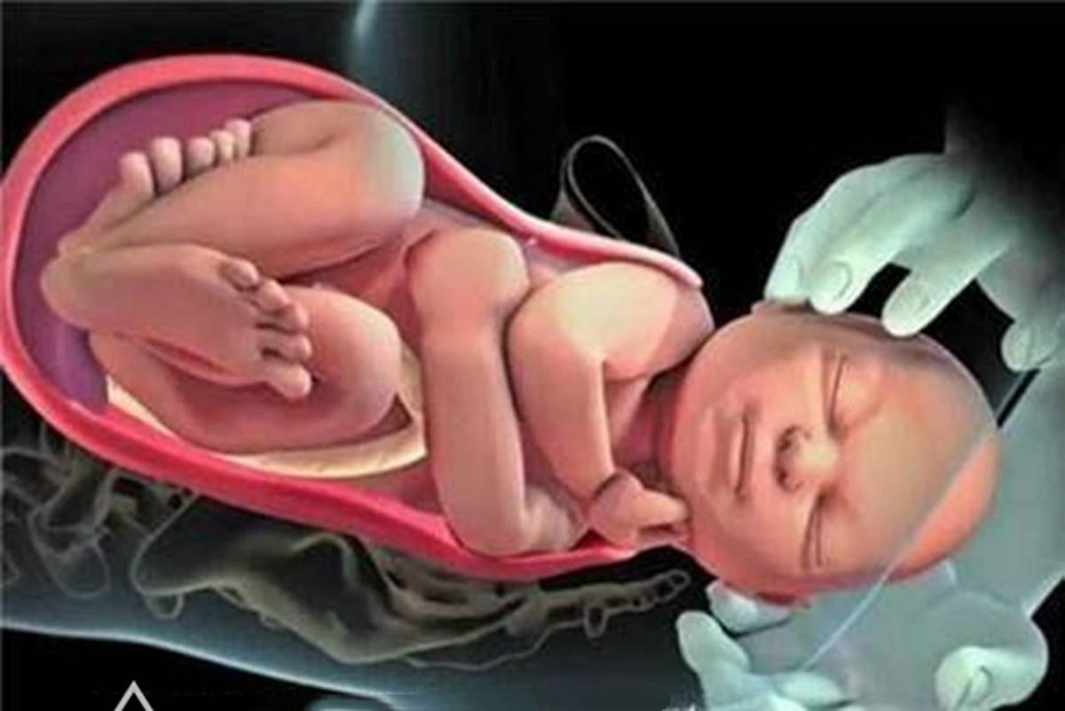 分娩开宫口疼痛程度,顺产生完娃骨缝啥时候闭合