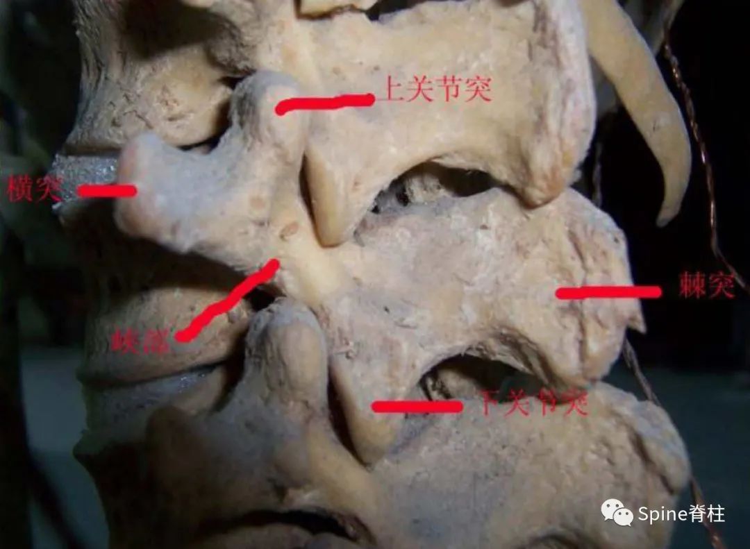 峡部裂和隐性峡部裂有区别吗,单纯峡部裂可以做峡部修复吗