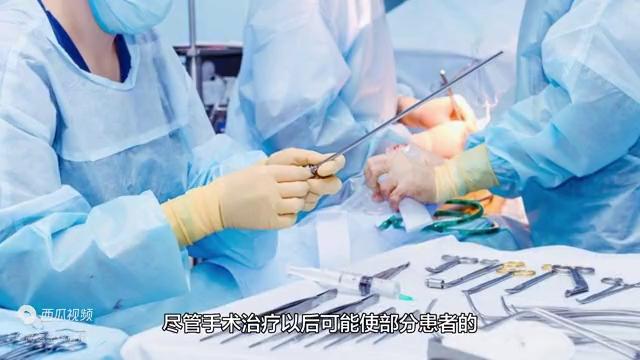 西医说多汗是什么原因,什么叫多汗症状