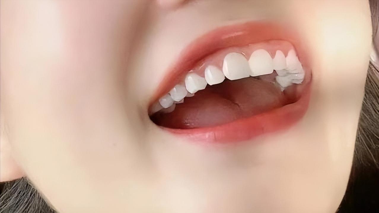 口臭星人口气清新的秘密！过来人一分钟揭晓答案！只需30天！