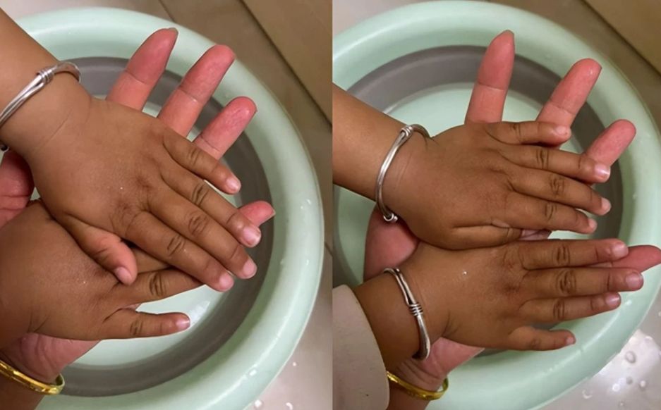 宝宝出生挺白为什么越长越黑,宝宝刚出生很白后面变黑红