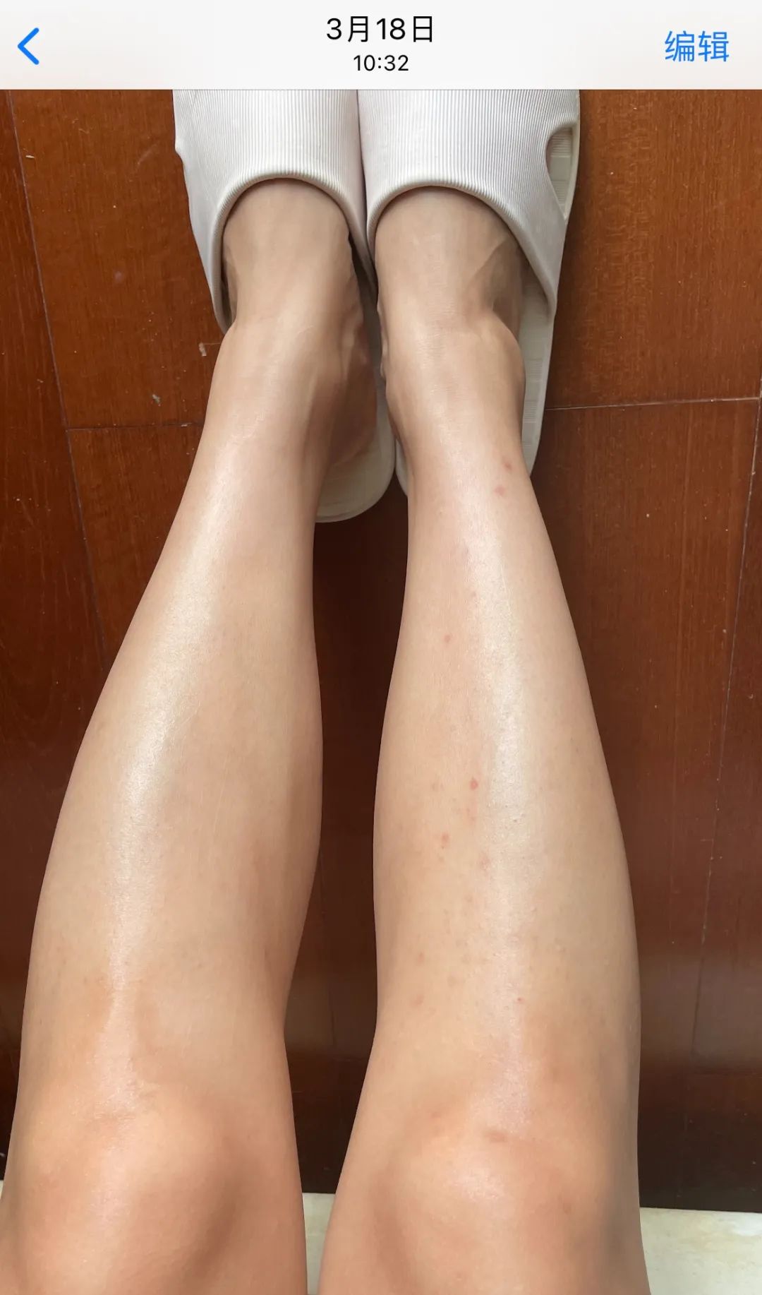 暑假一个月黄黑皮如何美白,天生黑皮的美白项目