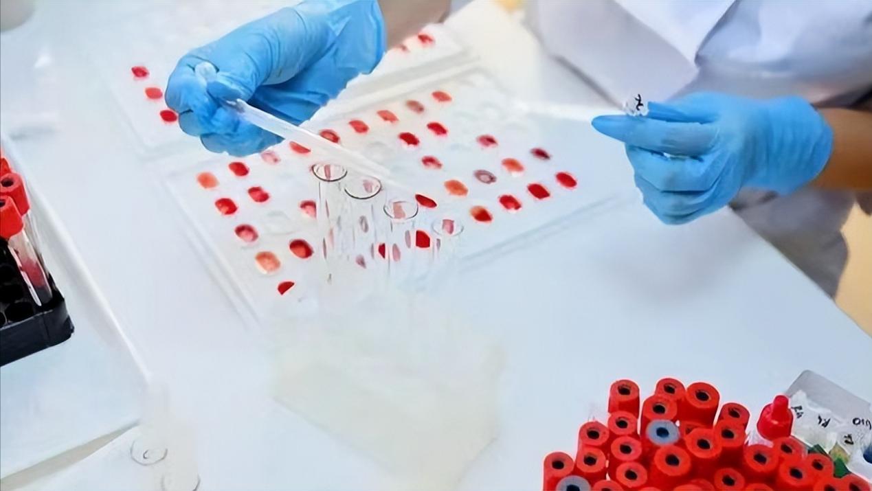 四种血型哪种血型容易得癌症,与癌症相关的血型是什么